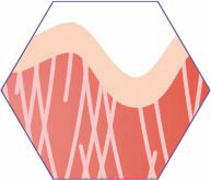 CRISTAL Skin Erwärmen von subkutanem Gewebe CRISTAL Skin Erwärmen von subkutanem Gewebe